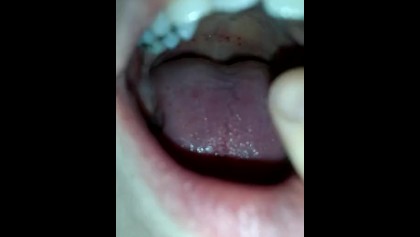 Tooth Fetish Porn - teeth fetish mouth tour Porn Videos - Free Sex Movies - OyOh